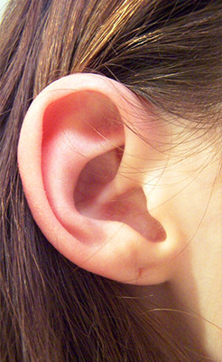 earlobe repair surgery