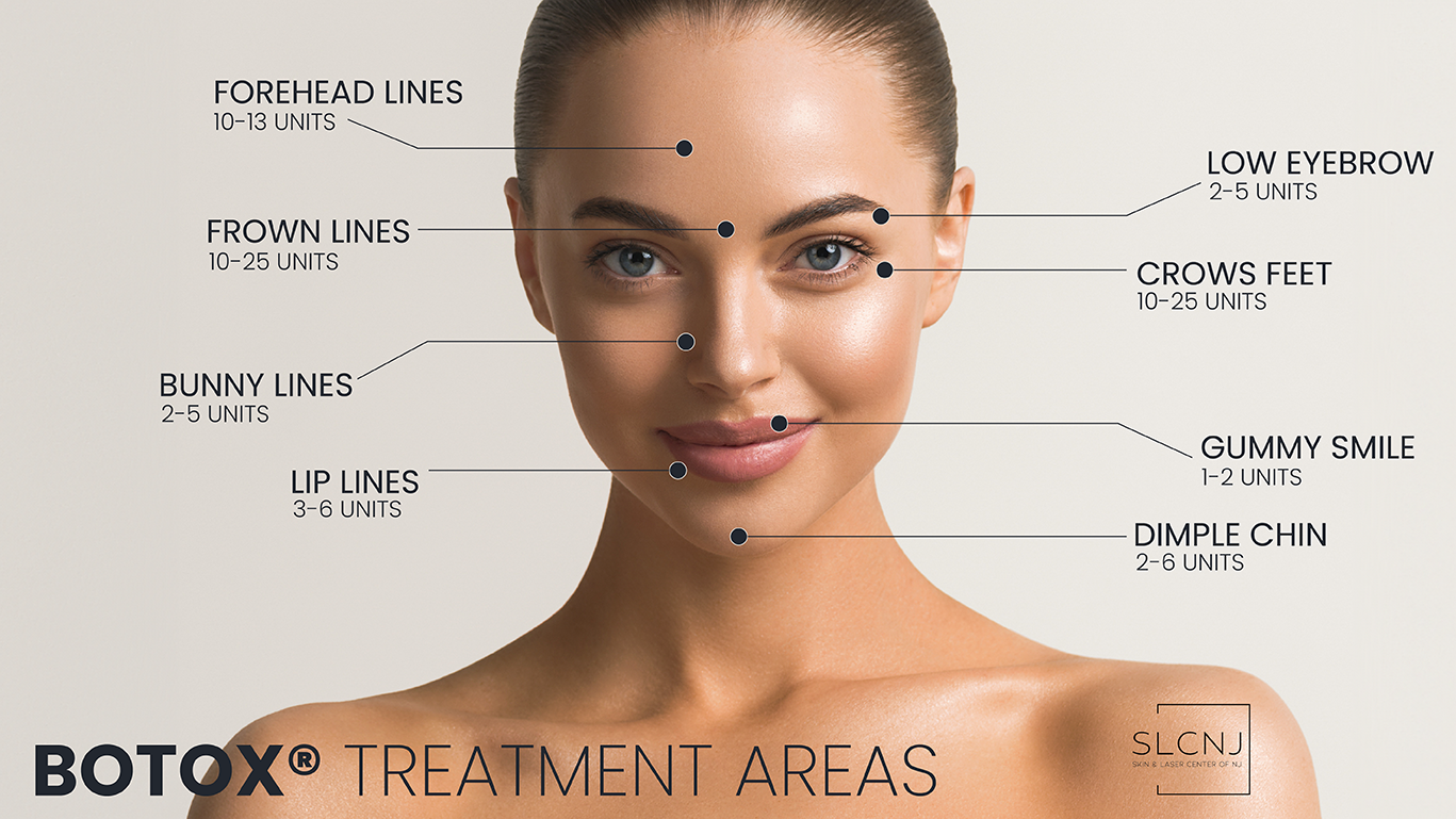 Discover BOTOX® treatment areas and units at Ramsey, New Jersey’s Skin and Laser Center of NJ.